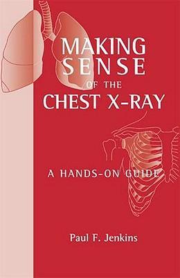 Making Sense of the Chest X-ray : A hands-on guide** - Image 46