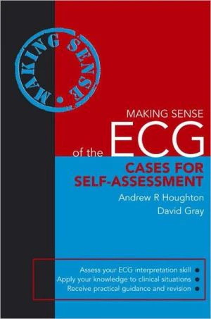 Making Sense of the ECG: Cases for Self-assessment** - Image 17