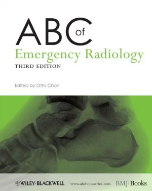 ABC of Emergency Radiology, 3e - Image 21