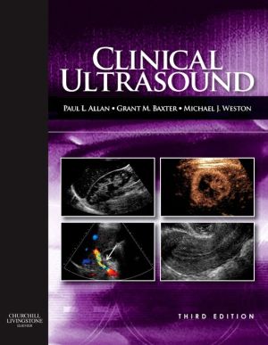 Clinical Ultrasound, 2-Volume Set, 3e - Image 21