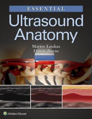 Essential Ultrasound Anatomy** - Image 25
