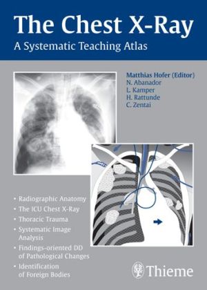 The Chest X-Ray: A Systematic Teaching Atlas - Image 17